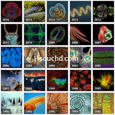 849 small world photomicrography competition thb